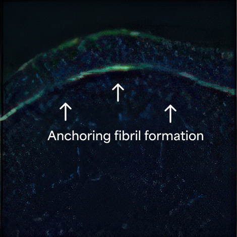 Immunofluorescent image of anchoring fibril formation