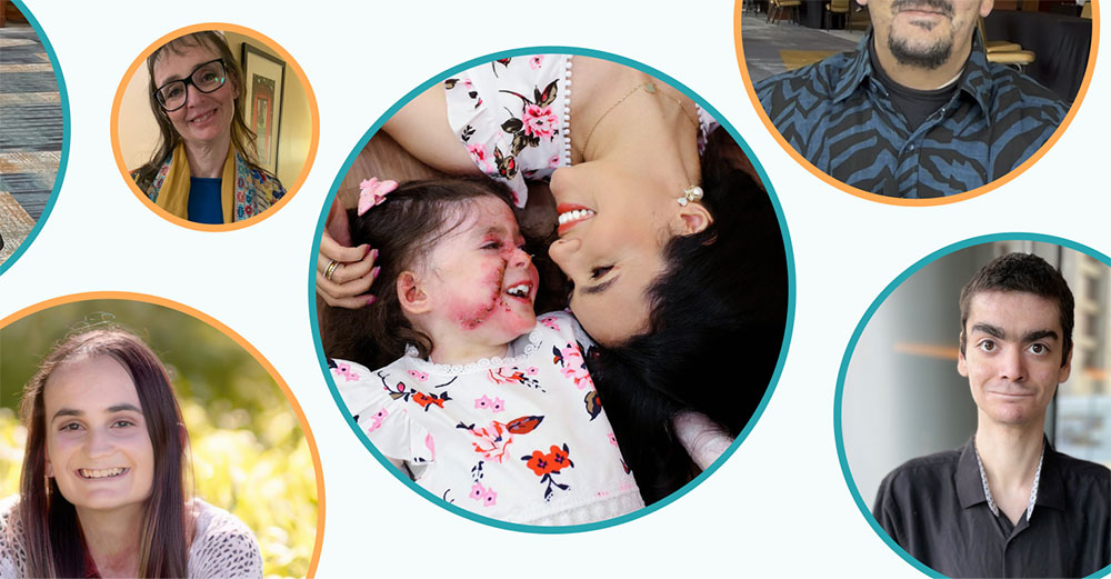 Collage of photos of ZEVASKYN patients and caregivers