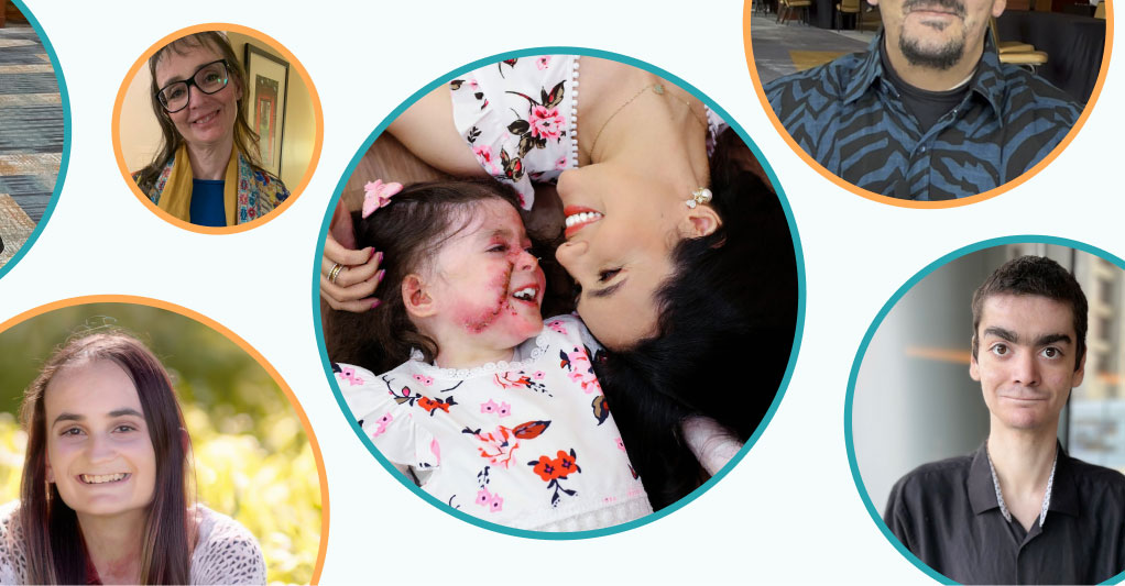 Patient, EB expert, and caregiver experiences